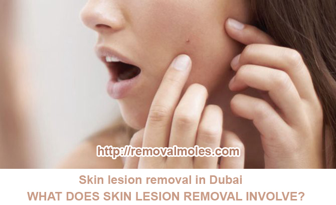 lesion removal in dubai uae